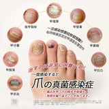 批發價-日式 灰甲保健貼20貼 (*1組2盒) (26/10截 1月底)