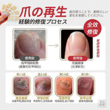批發價-日式 灰甲保健貼20貼 (*1組2盒) (26/10截 1月底)