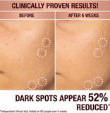 批發價-Charlotte Tilbury/CT Dark spot黑斑矯正煥採精華 4.5ml (16/7截 預計8月下旬)