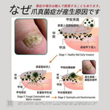 批發價-日式 灰甲保健貼20貼 (*1組2盒) (26/10截 1月底)